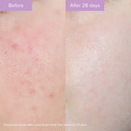 Brightening Plus Serum